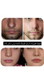 ژل کوچک کننده بینی دکس لاند نمونه اصلی